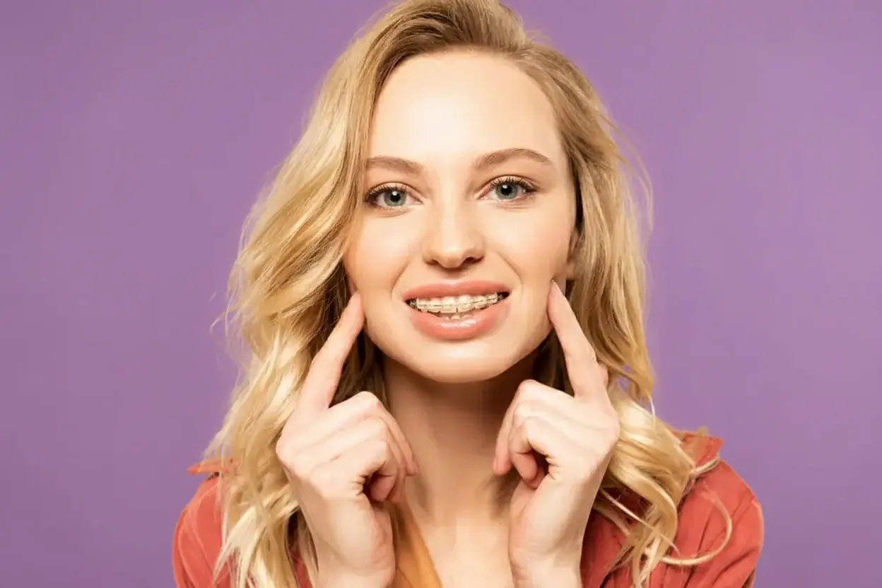 A young woman with long blonde hair points at her ceramic braces and smiles, promoting Redemption Orthodontics in Tallahassee, FL.