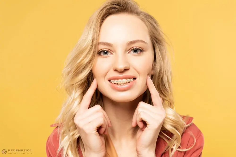 Smiling blonde woman points to her metal braces, promoting Redemption Orthodontics in Tallahassee, FL against a yellow background - How To Get Braces Glue Off Teeth in Tallahassee, FL 