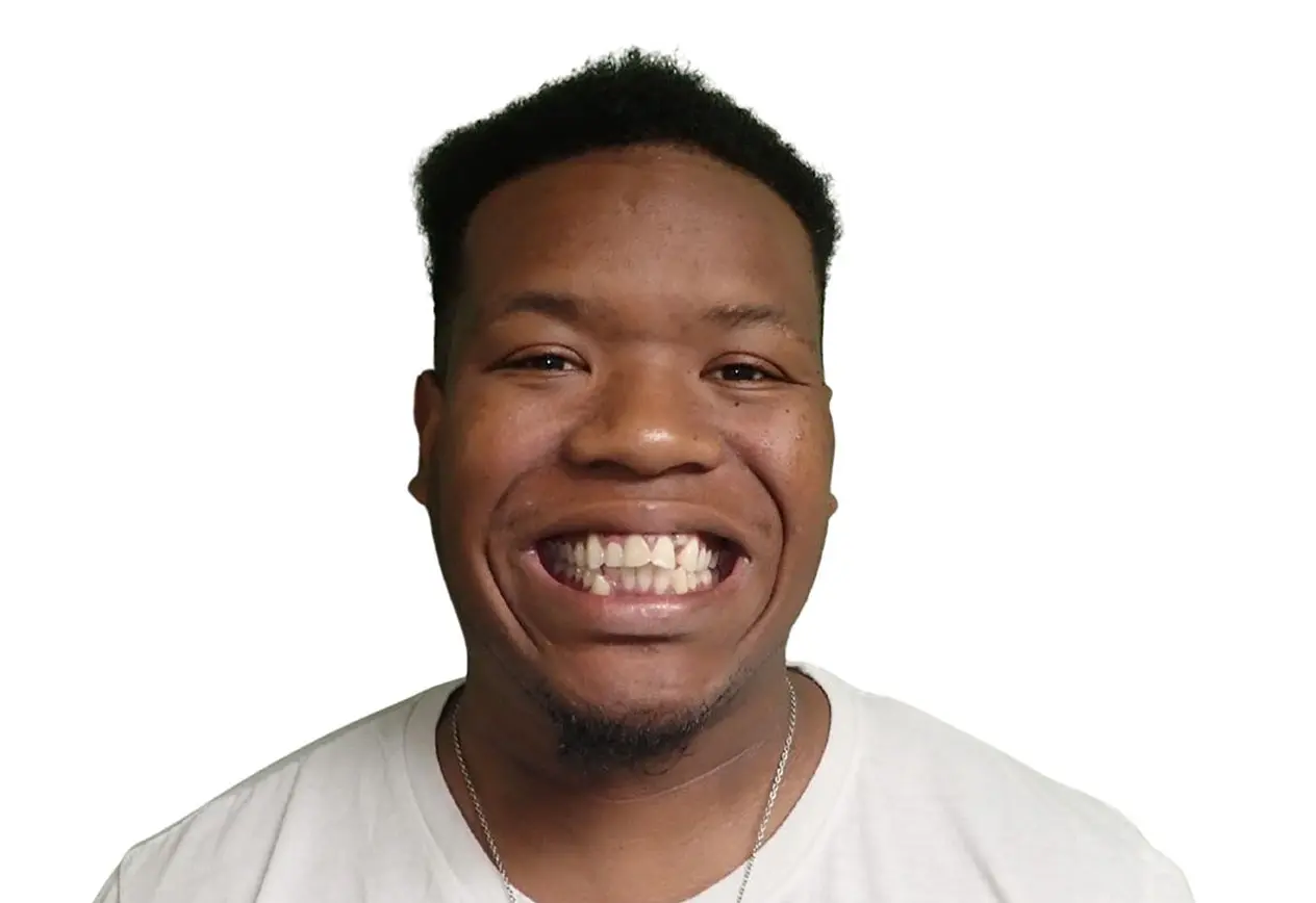 A man with short curly hair smiles, showing teeth before braces, at Redemption Orthodontics in Tallahassee, FL. White shirt, necklace.