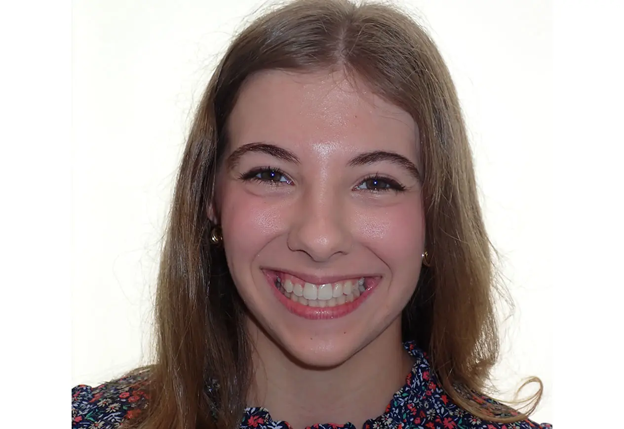 Smiling after braces at Redemption Orthodontics in Tallahassee, FL, a young woman with light brown hair wears a floral top and earrings.